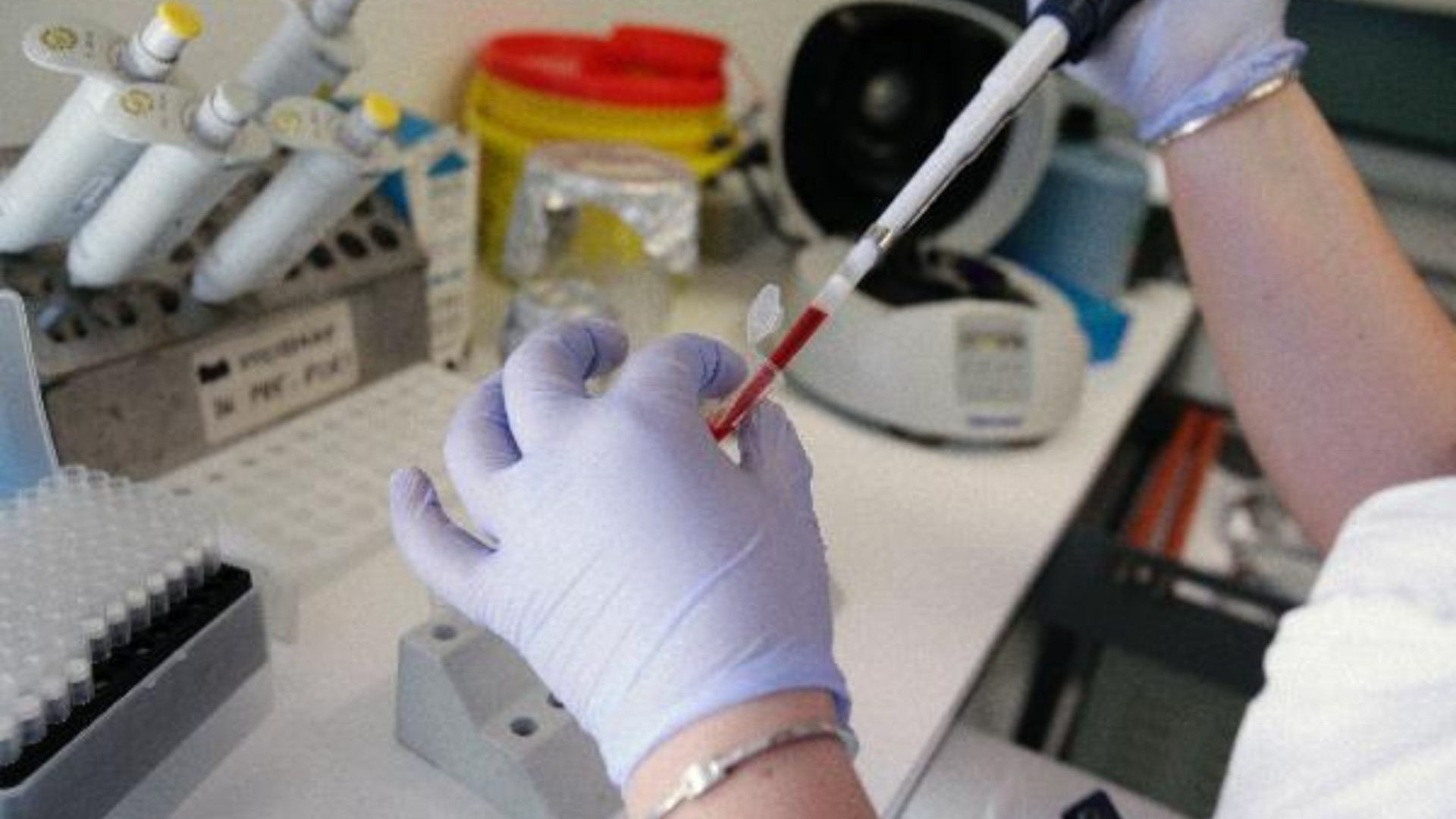 Screening colon-retto: a Piacenza 20 anni di prevenzione