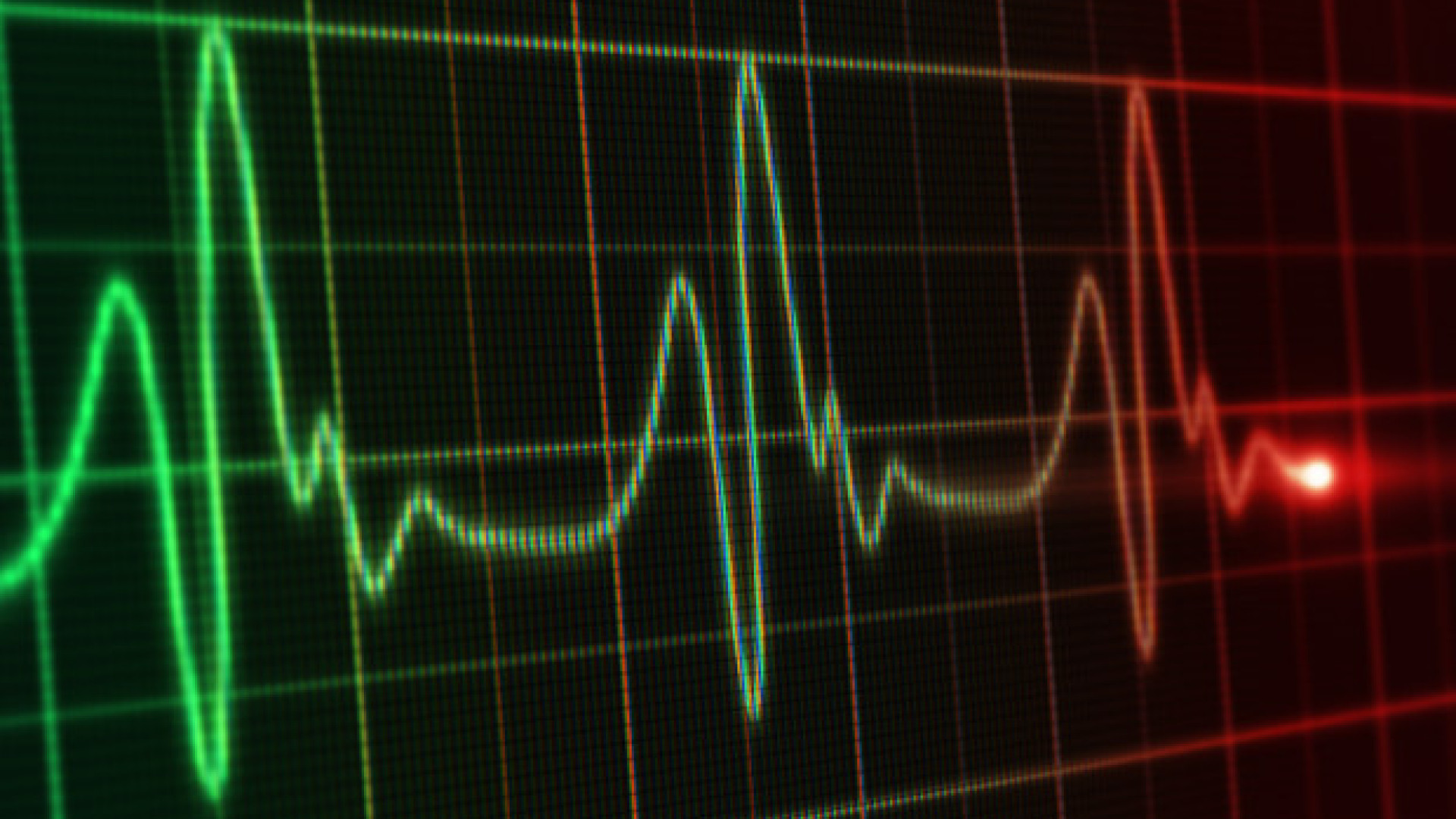 Aschieri: "Sedentarietà e poca attività fisica raddoppiati arresti cardiaci"