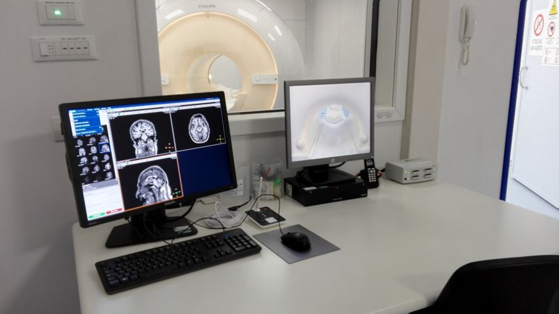 Sanità rallentata dal Covid: due mesi per una lastra e 100 giorni per visita oculistica