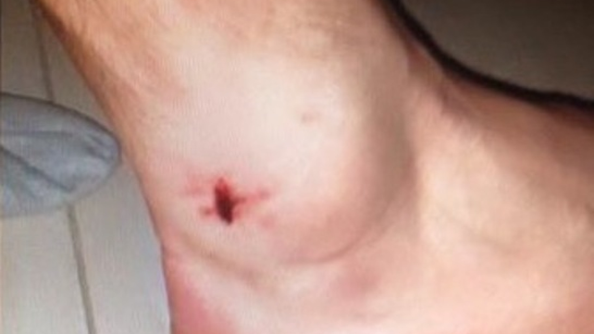 Pro Piacenza, sospiro di sollievo: esclusa la frattura per Danilo Alessandro