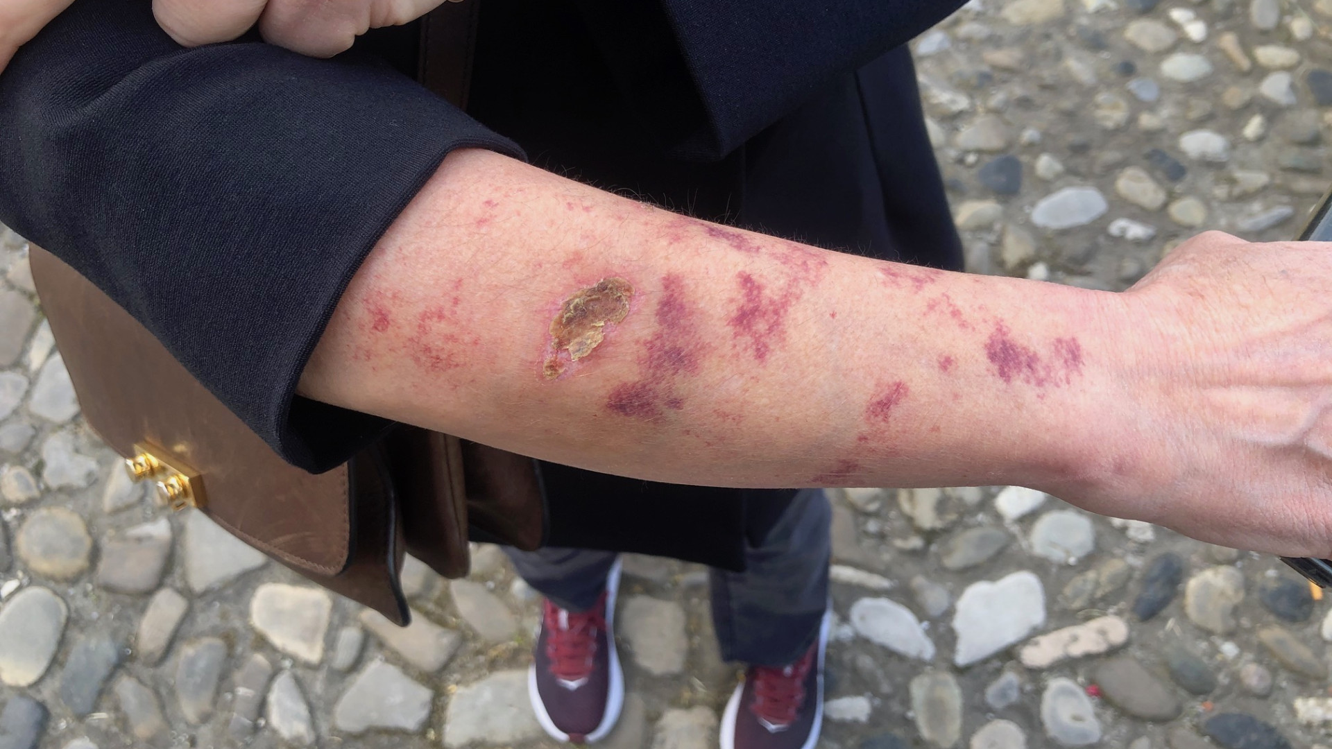 "Azzannata da un cane senza guinzaglio né museruola". A Piacenza 29 multe nel 2020