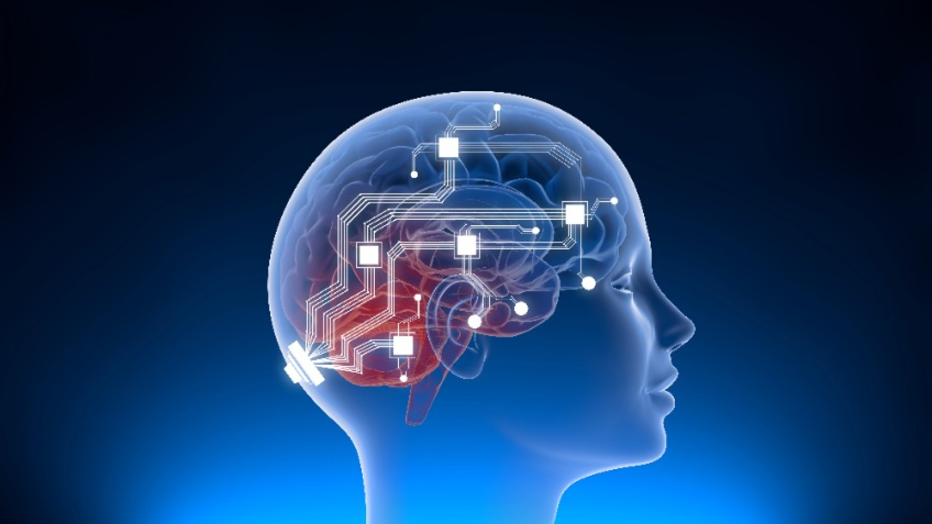 Neuralink annuncia: "Autorizzati a testare gli impianti nei cervelli umani"