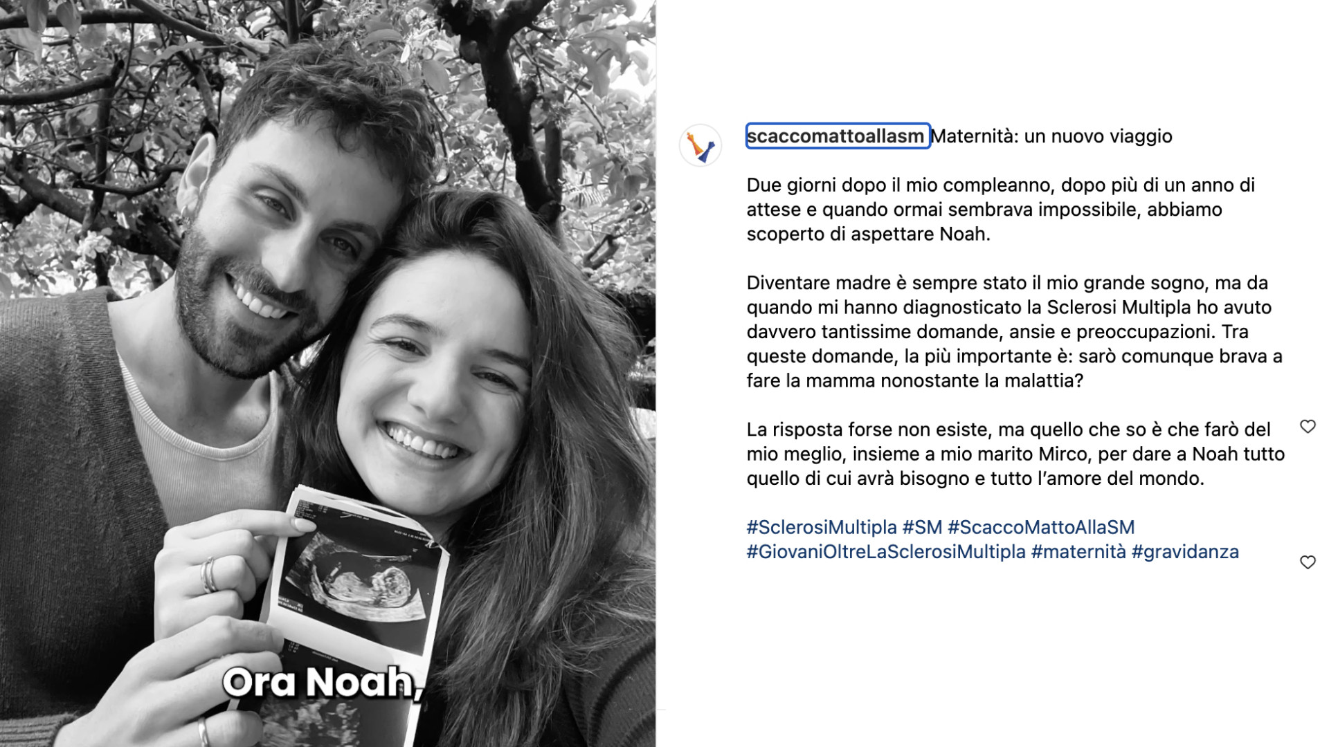La sclerosi non ferma il desiderio di diventare mamma: la storia di Gloria