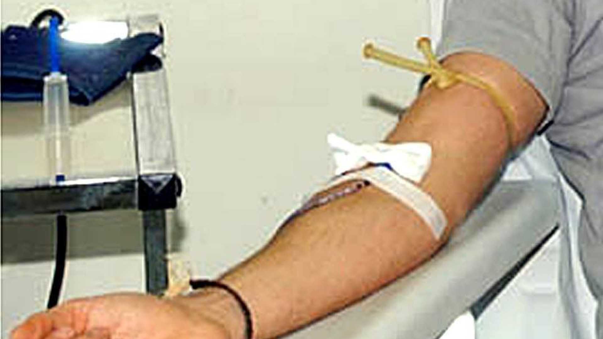 Boom di trasfusioni a luglio in regione, Donini: "Donate sangue prima di partire"