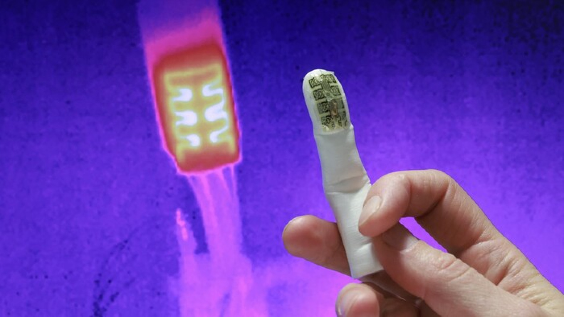 La protesi della mano può sentire il caldo e il freddo grazie all'arto fantasma
