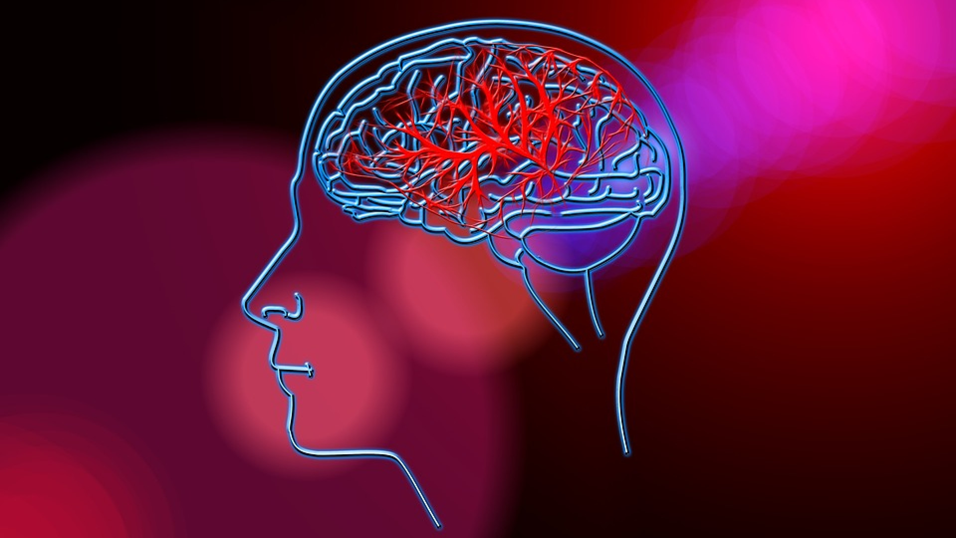 Lotta all'ictus cerebrale: cena benefica per sostenere l'associazione Alice