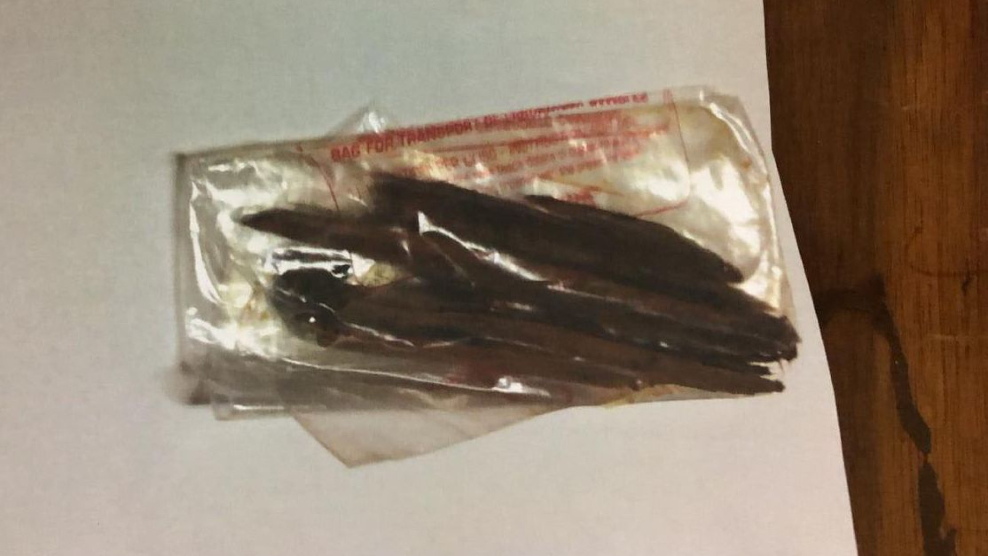 "Mi hanno ricucito la ferita senza togliere grossi pezzi di legno": denuncia di un piacentino