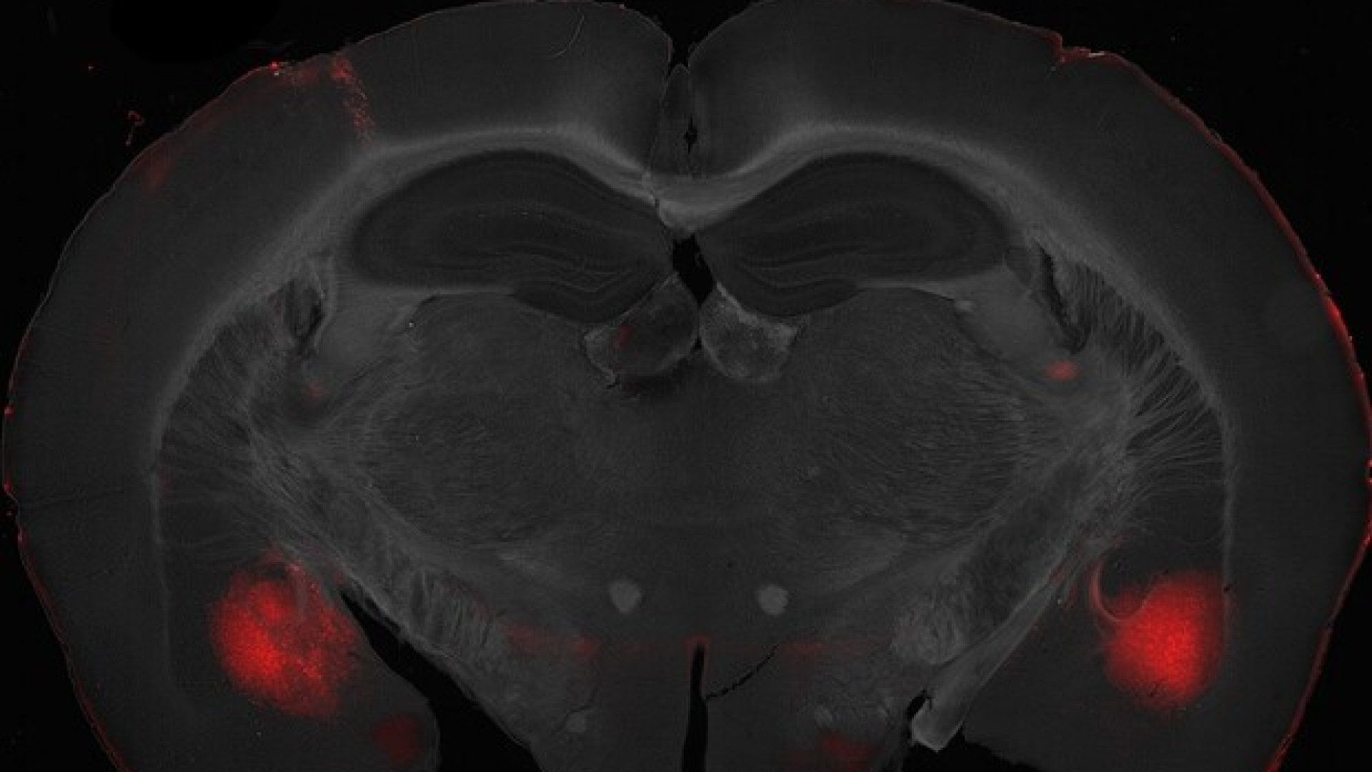 Cervello, ecco la centralina dell'egoismo: utile anche contro autismo e schizofrenia