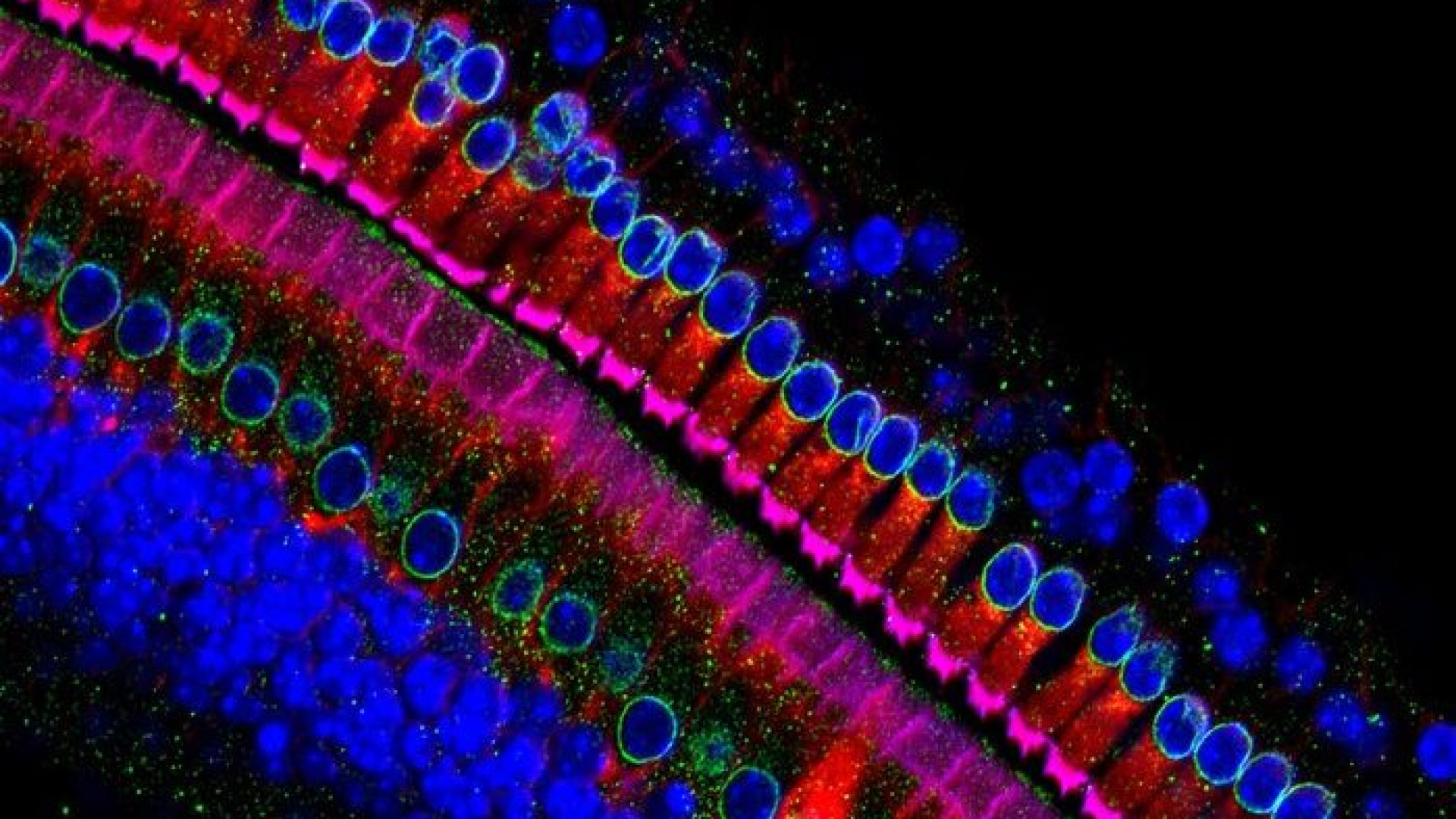 Scoperto il gene che fa da "interruttore" alle cellule e può ripristinare l'udito