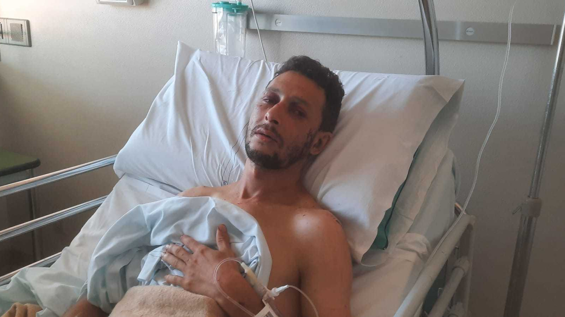 "Aggredito a colpi di spranga e abbandonato in un bosco": la testimonianza