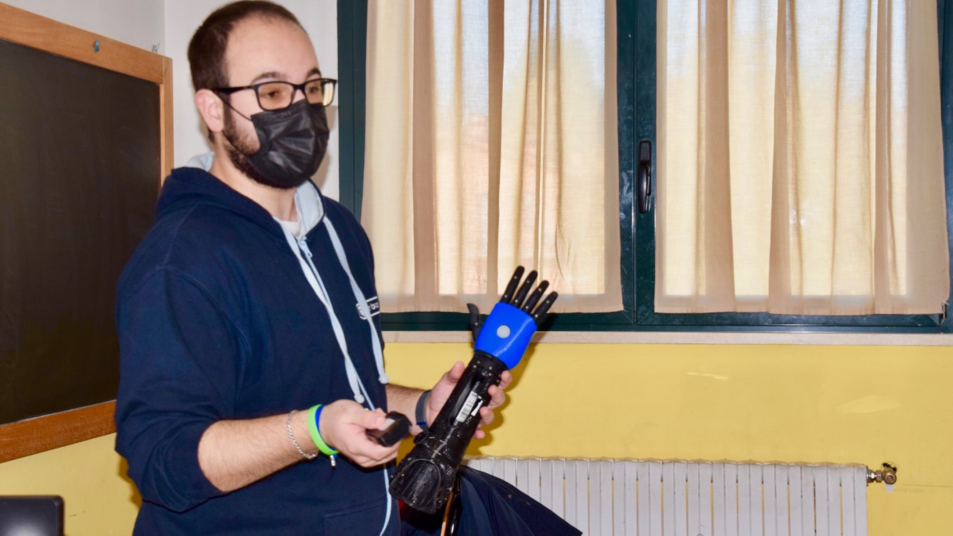 Hero Arm, il braccio da eroi: protesi di nuova concezione fatta con la stampante 3D