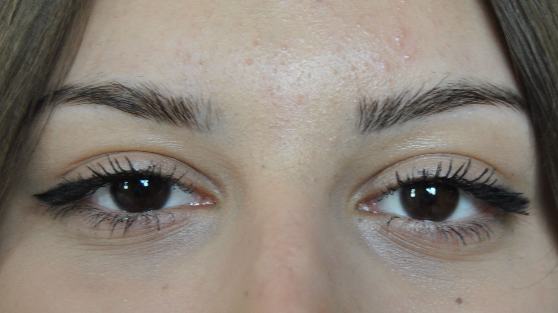 Funzionano i test sulla cornea in collagene di maiale: 14 pazienti tornano a vedere