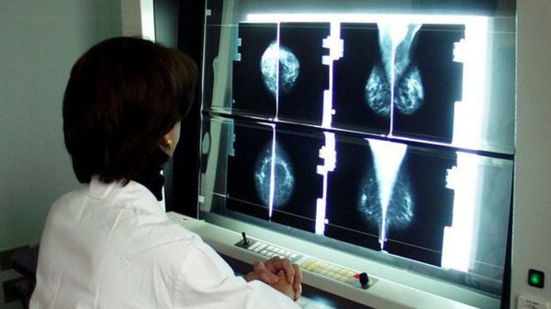 Tumori al seno: "Adesione allo screening troppo bassa, partono gli sms"