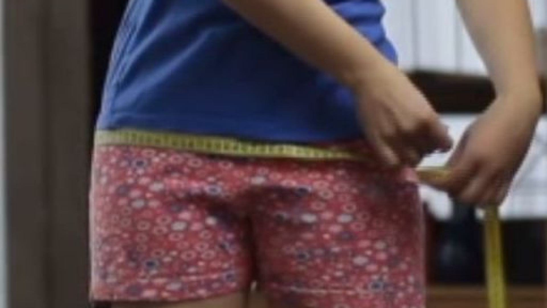 Anoressia e bulimia, impennata di casi: 15 in un mese. "Effetto lockdown"