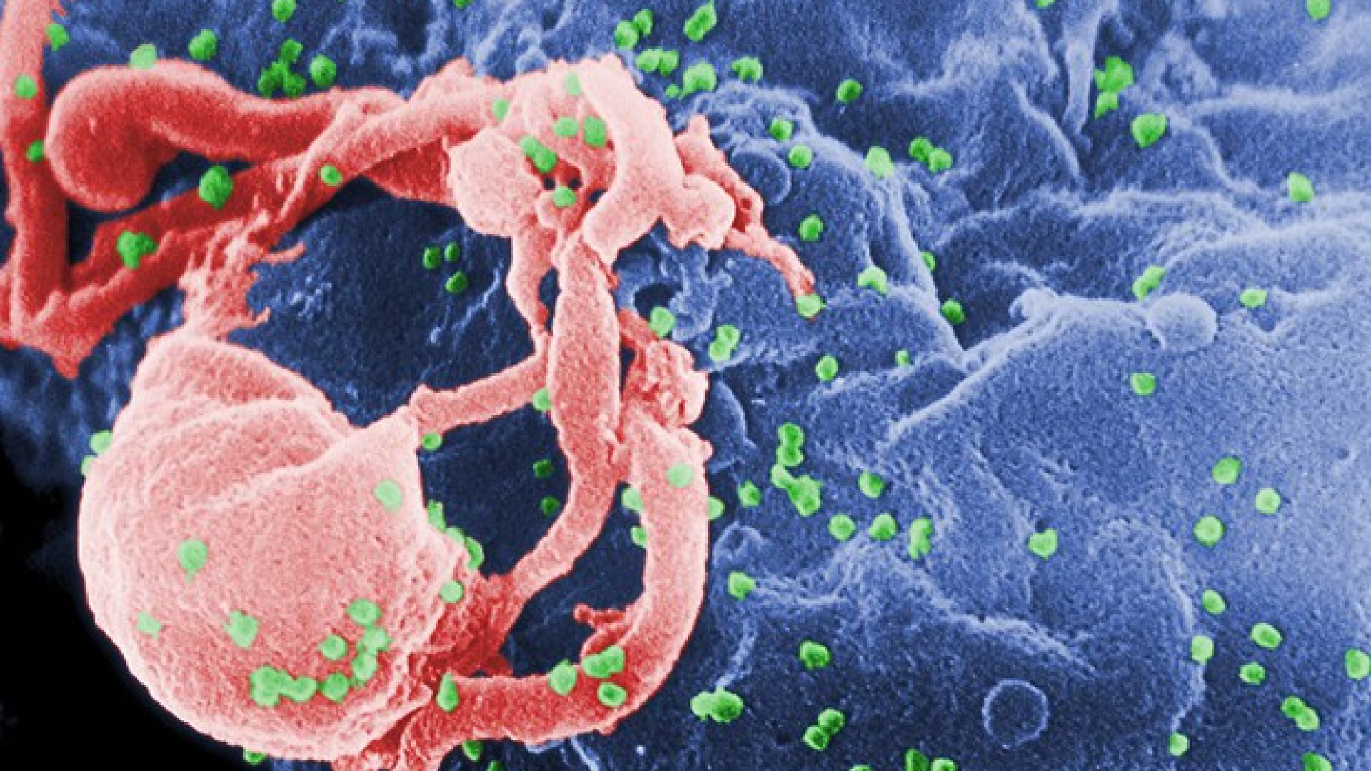 A Piacenza nel 2019 sono state 13 le nuove infezioni da Hiv