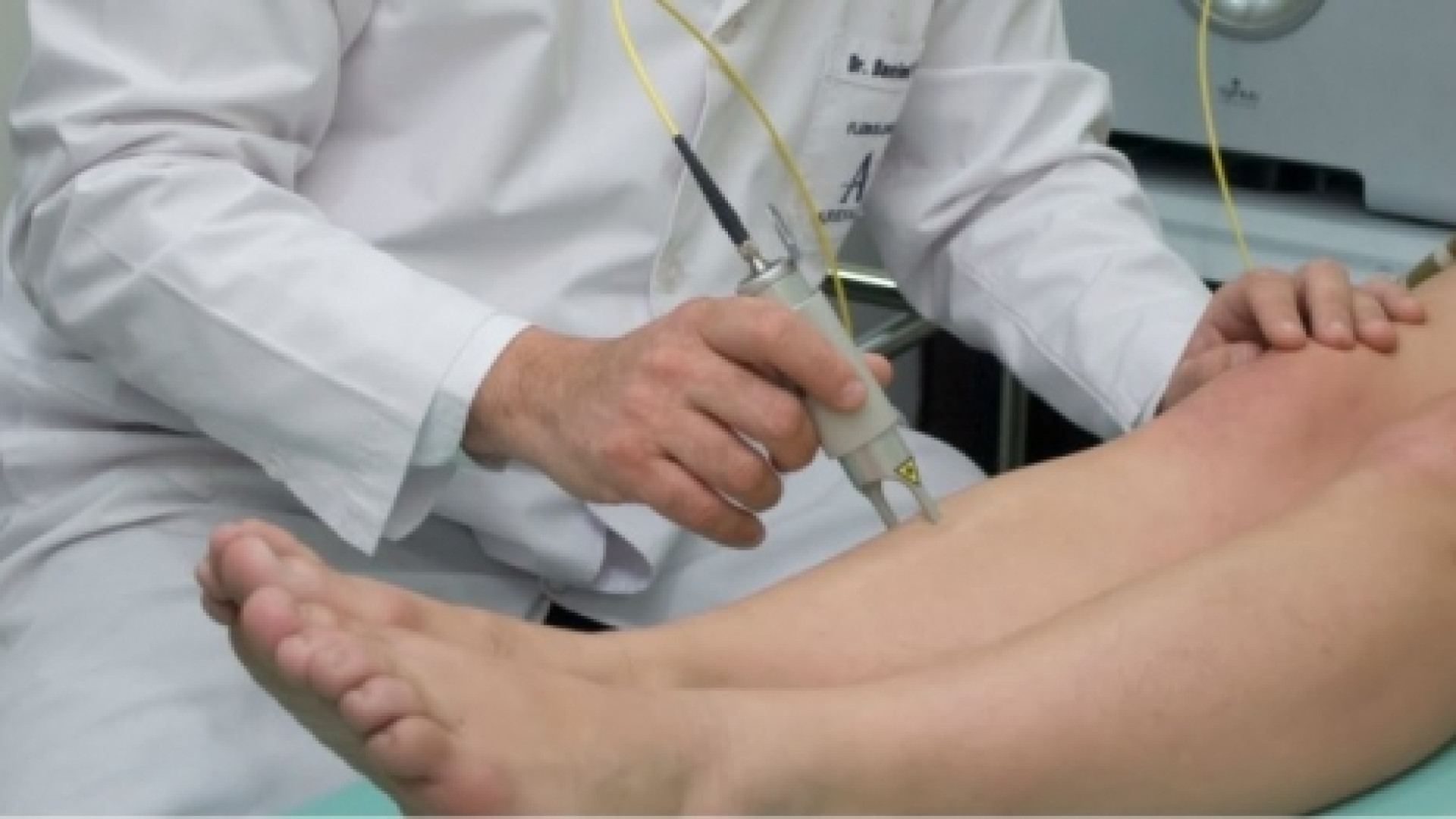 Flebologia: nuove cure e tecniche per i pazienti. Migliora anche l'estetica