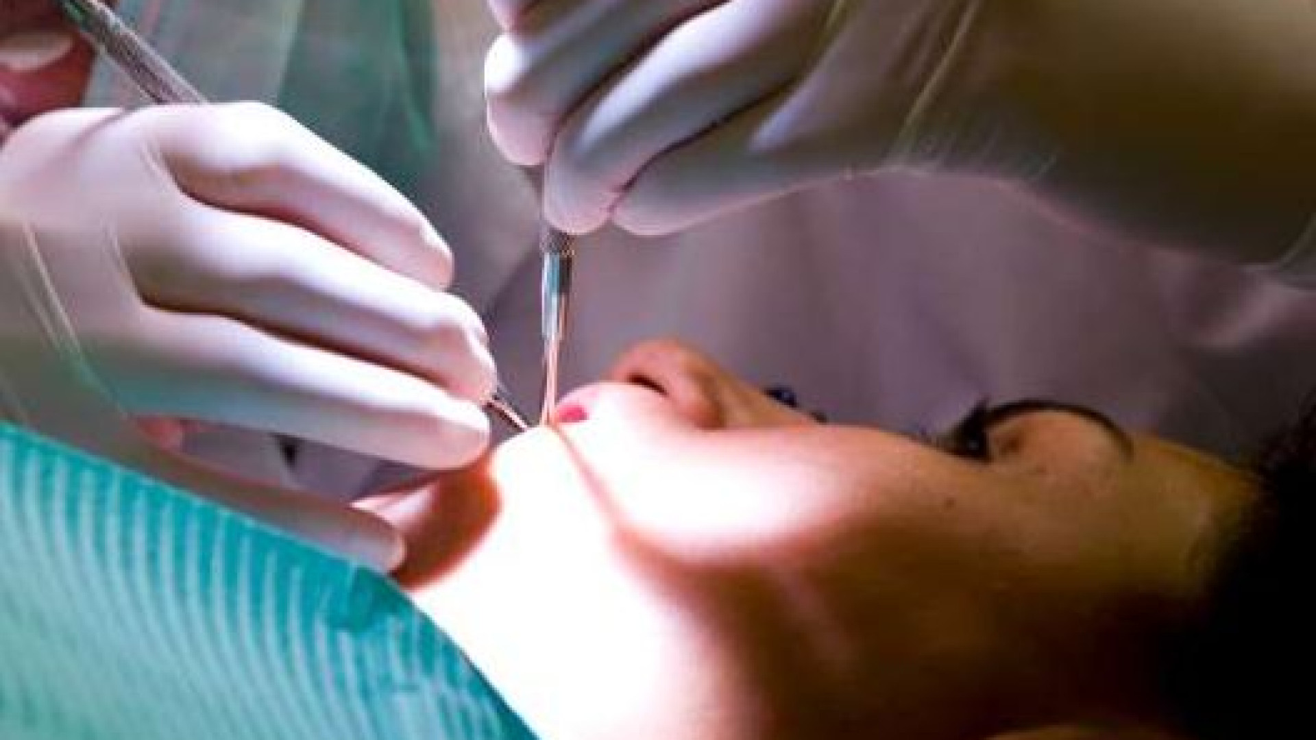 Odontoiatri al lavoro ma sospesi perché non vaccinati: due studi sequestrati